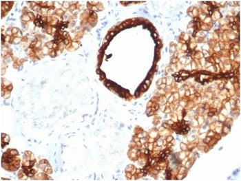 IHC staining of FFPE human salivary gland tissue with recombinant KRT7 antibody (clone KRT7/4387R). 