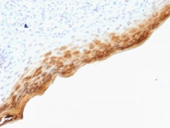 IHC testing of FFPE human skin with Filaggrin antibody (clone SPM181). Required HIER: boil tissue se