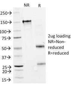 SDS-PAGE Analysis of Purified, BSA-Free Interferon alpha 2 Antibody (clone N27). Confirmation of Int