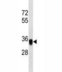 EpCAM Antibody