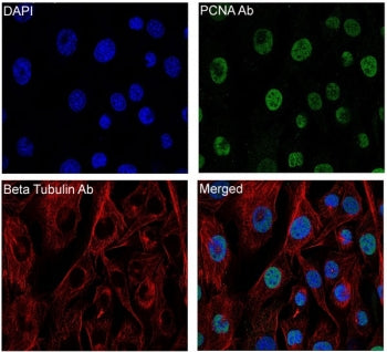 Beta Tubulin Antibody / TUBB