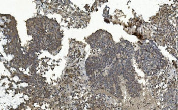 ERK5 Antibody / MAPK7