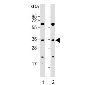 PIM2 Antibody