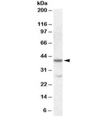 CBX8 Antibody