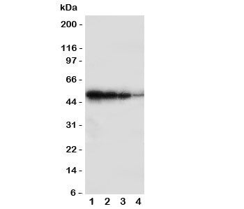 Western blot testing of BMPR1B antbody; Lane 1: Recombinant human protein 10ng; 2: 5ng; 3: 2.5ng; 4: