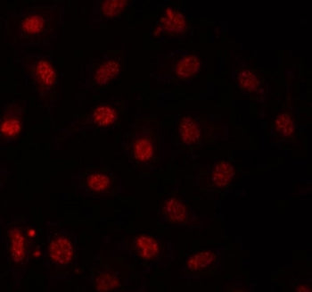 PRPF31 Antibody / PRP31