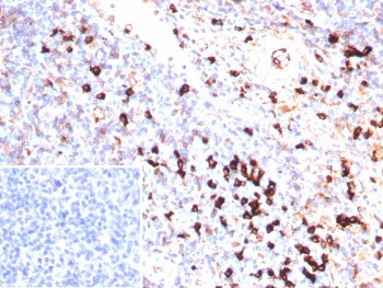 Lambda Light Chain Antibody