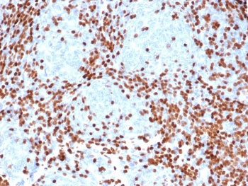 DNTT Antibody / TdT / DNA Nucleotidylexotransferase