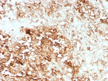 IHC staining of FFPE human adrenal gland tissue with recombinant CLU antibody (clone rCLU/9149). HIE