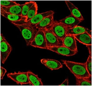 Immunofluorescent staining of PFA-fixed human HeLa cells using Chk2 antibody (green, clone PCRP-CHEK