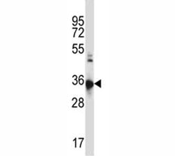 CCR10 Antibody