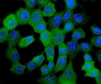 HSP22 Antibody