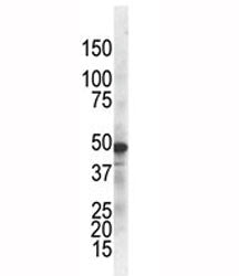 IKK gamma Antibody