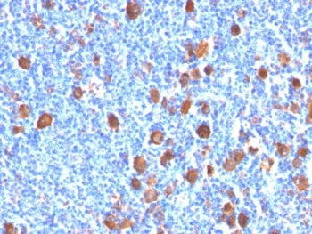 Fascin Antibody