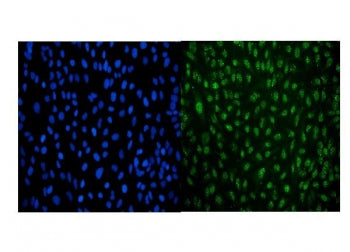 LSM8 Antibody