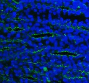 Immunofluorescent staining of FFPE rat kidney tissue with SLC12A1 antibody (green) and DAPI nuclear 