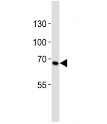 CD30 Antibody