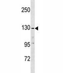 EGF Antibody / Epidermal Growth Factor, 0.08ml
