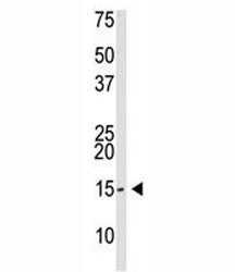 SUMO-3 Antibody