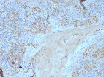 Fas Antibody / CD95