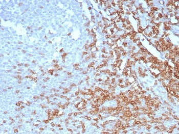 IHC staining of FFPE human tonsil tissue with CD7 antibody (clone CD7/7605). HIER: boil tissue secti