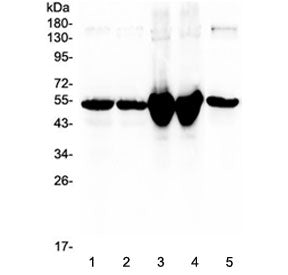 Vdbp Antibody / Vitamin D binding protein
