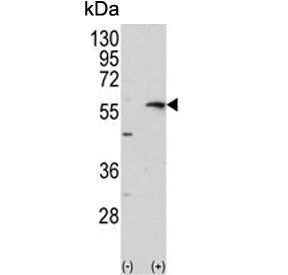 Western blot testing of 1) non-transfected and 2) transfected 293 cell lysate with Collagenase 3 ant