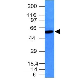 Western blot testing of Vimentin antibody and Raji cell lysate. Expected molecular weight: 53-58 kDa