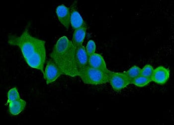 CLPX Antibody