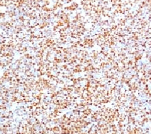 Cyclin D1 Antibody / CCND1