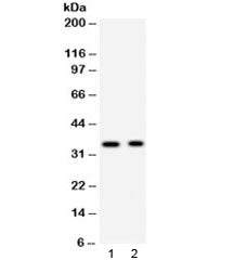 Synaptophysin Antibody
