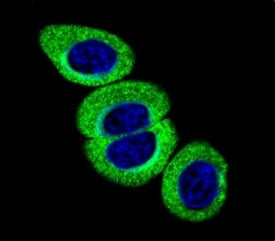 Phospho-ATM Antibody (pS1981)
