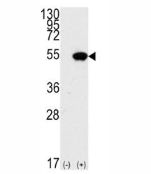p53 Antibody / TP53, 0.08ml