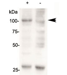 Western blot of 143B cells overexpressing human AARS2 tested with AARS2 antibody (mock transfection 