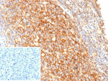 IHC staining of FFPE human tonsil tissue with recombinant CR2 antibody (clone rCR2/9537). Inset: PBS