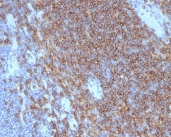 CD4 Antibody