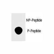 FOXP3 Antibody (phospho-S418)
