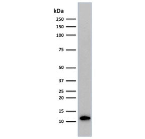 Western blot testing of human Raji cell lysate with Beta-2 Microglobulin antibody (clone C21.48A1). 