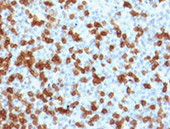 PDCD1 Antibody / PD-1 / PD1