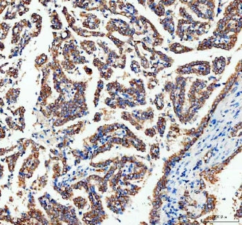 AK1 Antibody / Adenylate Kinase 1