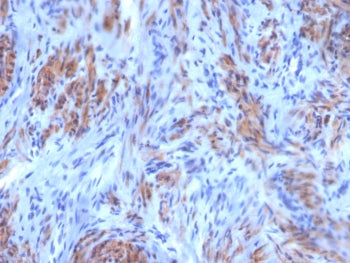 IHC staining of FFPE human uterus tissue with SMMHC antibody (clone SM-M10). HIER: boil tissue secti