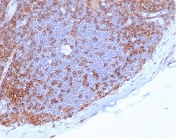 IHC staining of FFPE human lymph node tissue with CD4 antibody (clone CD4/7144) at 2ug/ml in PBS for