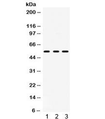 Western blot testing of 1) rat brain, 2) rat testis and 3) human U-87 MG lysate with 5HT2AR antibody