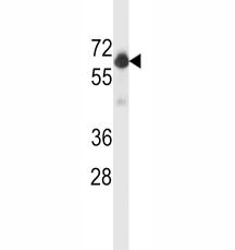 Beclin-1 Antibody