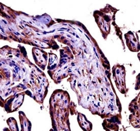 C9 Antibody (Complement 9)