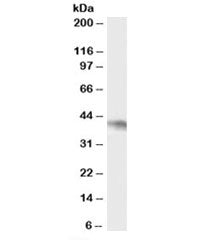 Western blot testing of Daudi cell lysate with NCF4 antibody at 0.5ug/ml. Predicted molecular weight