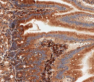 IHC testing of FFPE mouse small intestine tissue with Nlrp6 antibody. HIER: steam section in pH9 EDT