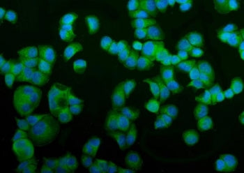 Vesicle-fusing ATPase Antibody / NSF