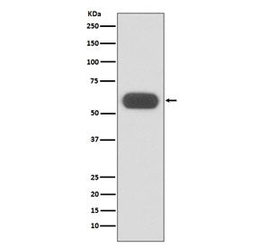 GBA Antibody / Lysosomal acid glucosylceramidase