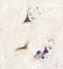 NGF Antibody / Beta Nerve Growth Factor